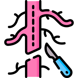 Renal Peripheral Angioplasty
